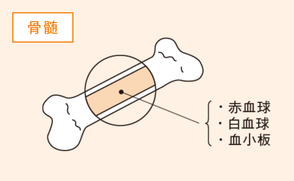 骨髄移植とは